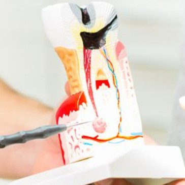 Endodontologie_3